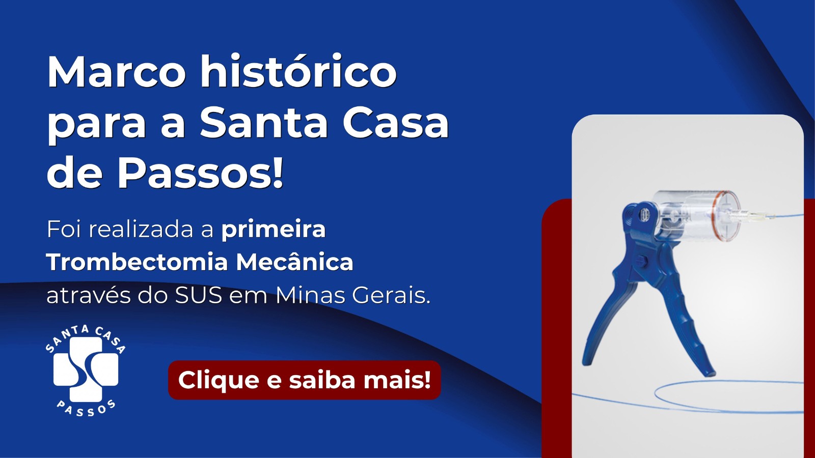 Santa Casa de Passos faz 1ª trombectomia mecânica pelo SUS em Minas Gerais